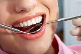 Root-Canal-Treatment