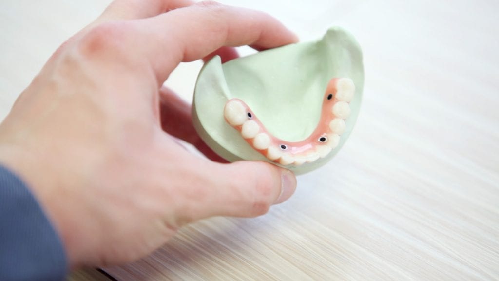 Why Dental Implants Are The Best Treatment For Missing Teeth