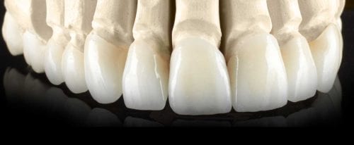 cosmetic dentistry treatment