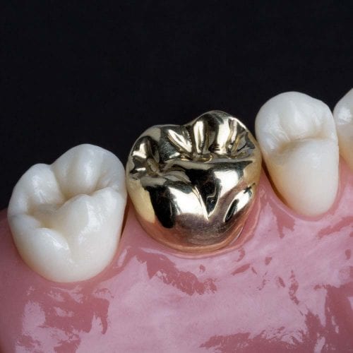 cosmetic dentistry treatment