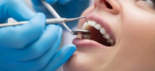 Periodontal-Treatment